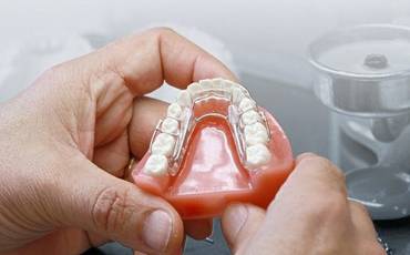 How 3D Printing is Transforming Dental Industry